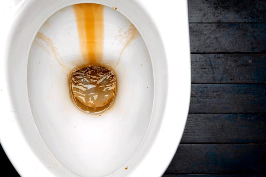 Des toilettes avec des traces marrons, c'est pas beau à voir